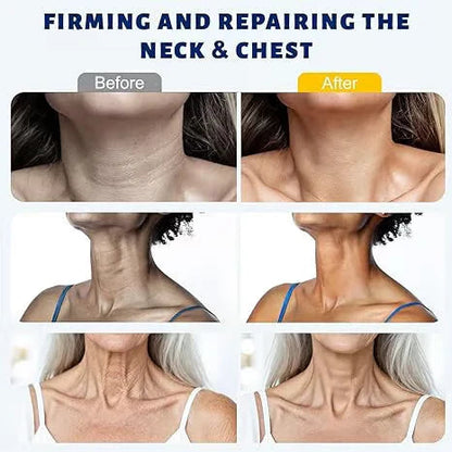 Roller Massage Neck Cream 🧴 Collagen & Hyaluronic Acid | Firms Neck, Reduces Wrinkles & Double Chin