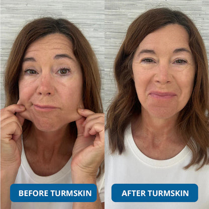 🔥 Limited Time Offer – 3 Hyaluronic Acid Ultra Hydrating Serum for Deep Moisture, Plump & Smooth-Looking Skin