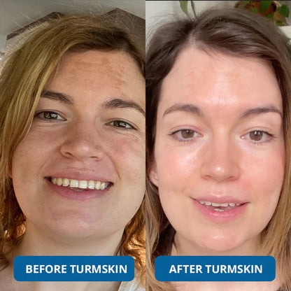 🔥 Limited Time Offer – 3 Hyaluronic Acid Ultra Hydrating Serum for Deep Moisture, Plump & Smooth-Looking Skin