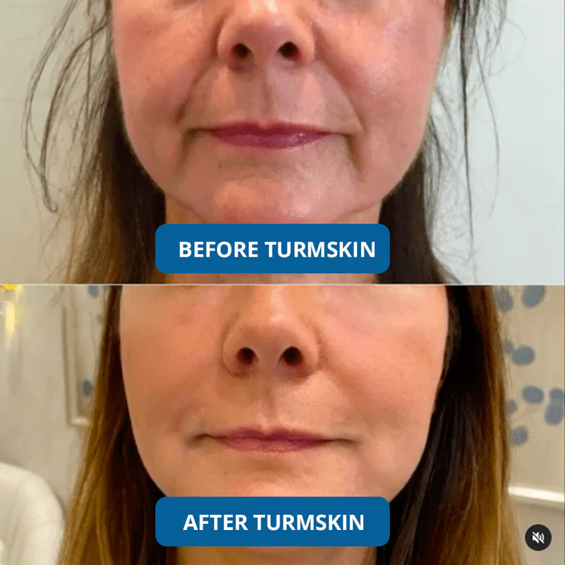 🔥 Limited Time Offer – 3 Hyaluronic Acid Ultra Hydrating Serum for Deep Moisture, Plump & Smooth-Looking Skin