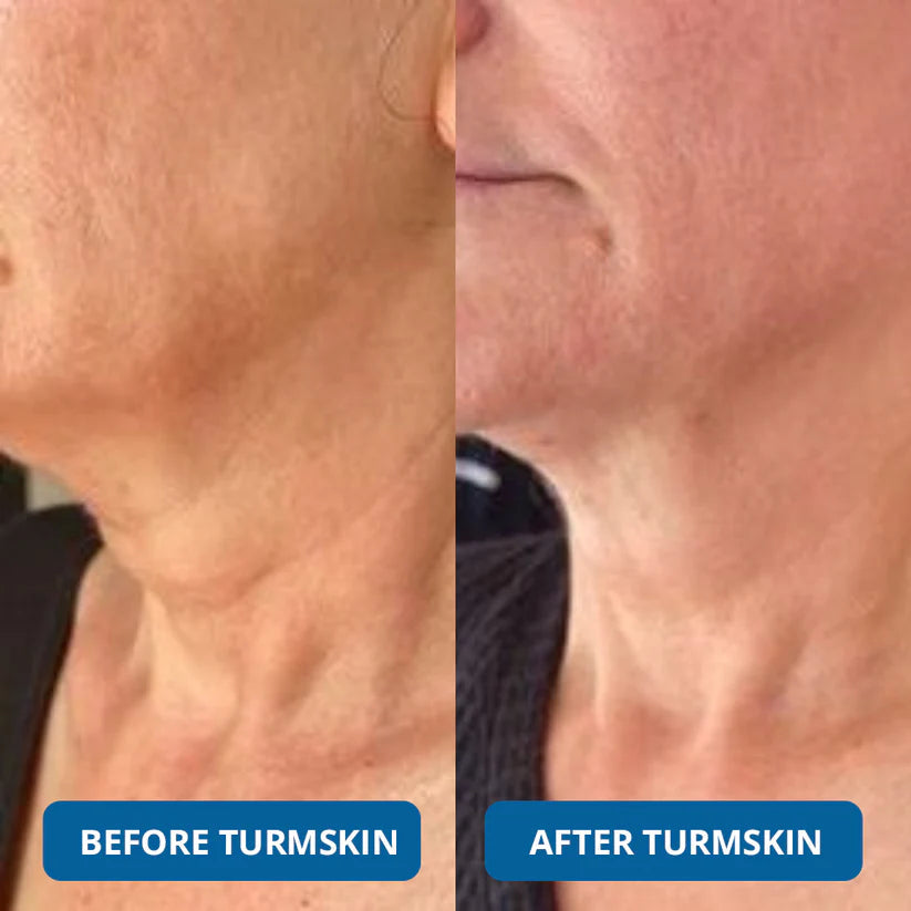🔥 Limited Time Offer – 3 Hyaluronic Acid Ultra Hydrating Serum for Deep Moisture, Plump & Smooth-Looking Skin