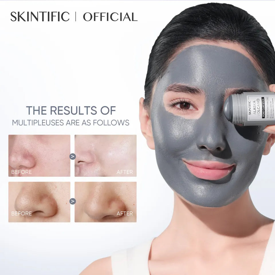 🔥 Limited Time Offer – Alaska Volcano Clay Mask Stick for Pore Cleansing, Blackhead Removal & Smoother-Looking Skin
