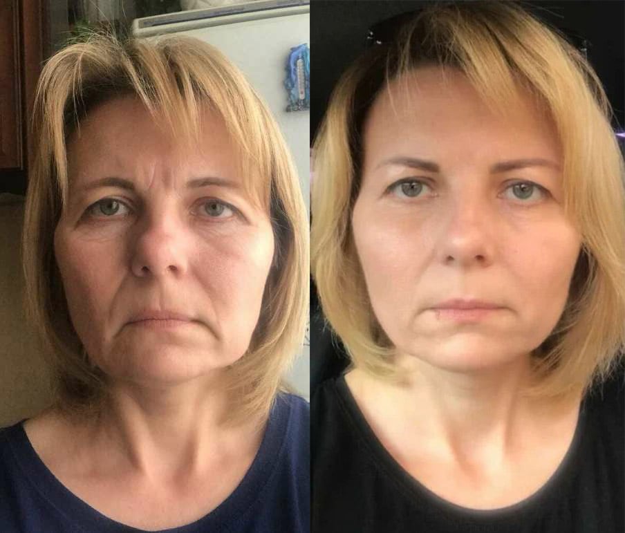 Roller Massage Neck Cream 🧴 Collagen & Hyaluronic Acid | Firms Neck, Reduces Wrinkles & Double Chin