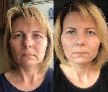 Roller Massage Neck Cream 🧴 Collagen & Hyaluronic Acid | Firms Neck, Reduces Wrinkles & Double Chin