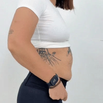 🔥 Buy 1 get 1 free🔥 - Women's Tummy Control Butt-Lifting Shapewear
