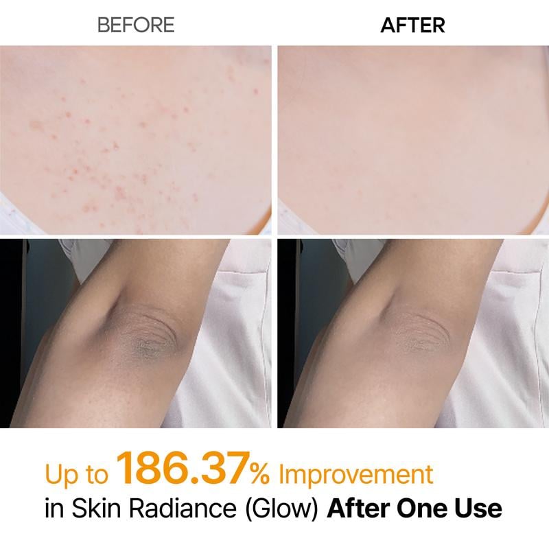 Peel Shot Keratin Care Kojic Acid Turmeric Spray 200ml Pore Clearing Exfoliating Formula Skin Repair Scrub