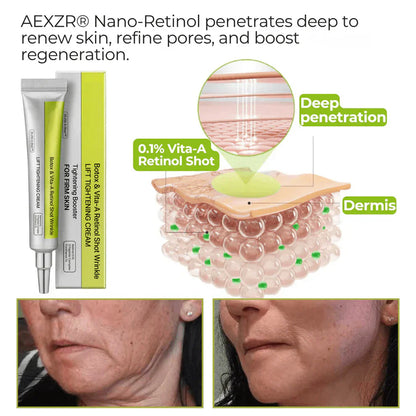 🌿 💫Tiworld® Botox & Vita-A Retinol Shot Wrinkle-Lift Tightening cream - Last Day Promotion 50% OFF
