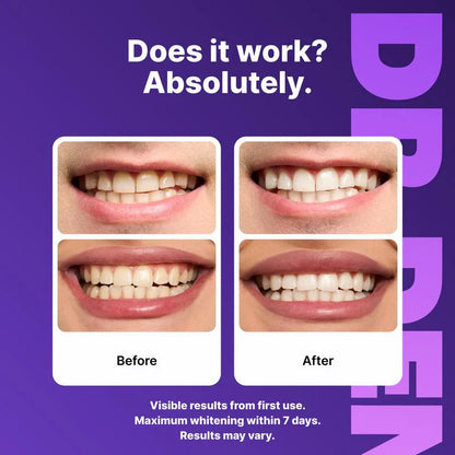 💥Buy 2 Get 1 Free🦷Purple Whitening Strips
