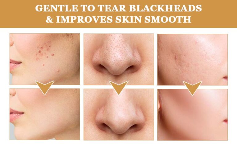 50yr old turned 20yrs with our gold peel off mask