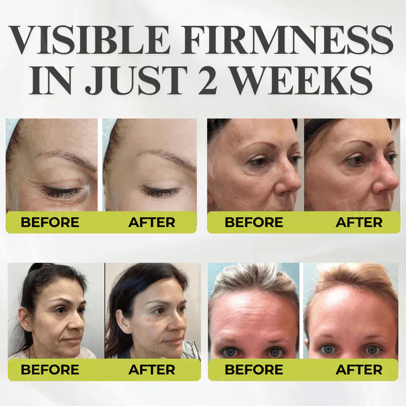 🌿 💫Tiworld® Botox & Vita-A Retinol Shot Wrinkle-Lift Tightening cream - Last Day Promotion 50% OFF