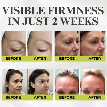🌿 💫Tiworld® Botox & Vita-A Retinol Shot Wrinkle-Lift Tightening cream - Last Day Promotion 50% OFF