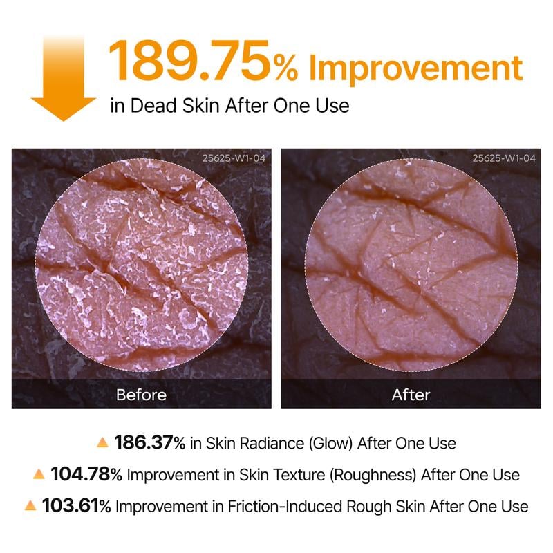 Peel Shot Keratin Care Kojic Acid Turmeric Spray 200ml Pore Clearing Exfoliating Formula Skin Repair Scrub