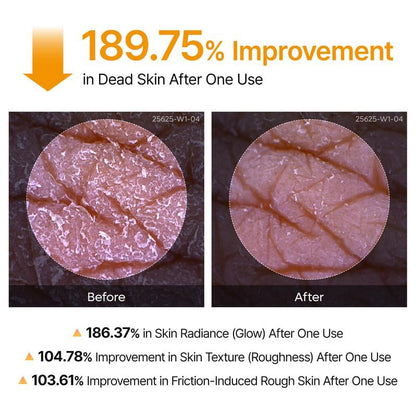 Peel Shot Keratin Care Kojic Acid Turmeric Spray 200ml Pore Clearing Exfoliating Formula Skin Repair Scrub