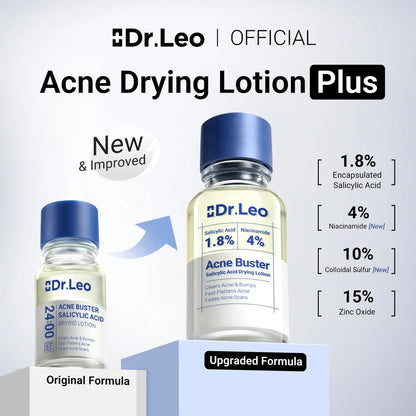 ⭐⭐⭐⭐⭐Overnight Acne Drying Lotion – Fast Spot Treatment for Pimples & Breakouts