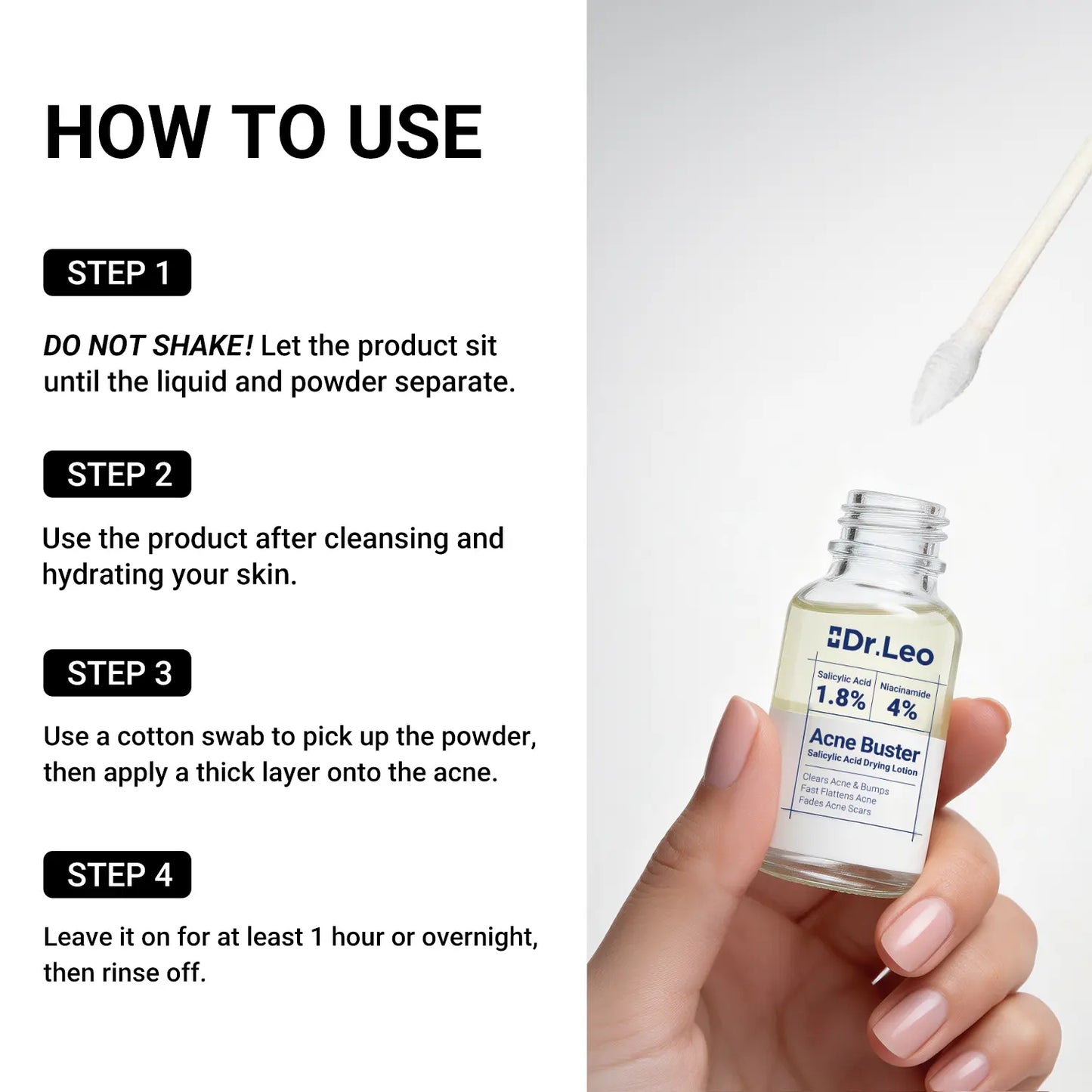 ⭐⭐⭐⭐⭐Overnight Acne Drying Lotion – Fast Spot Treatment for Pimples & Breakouts