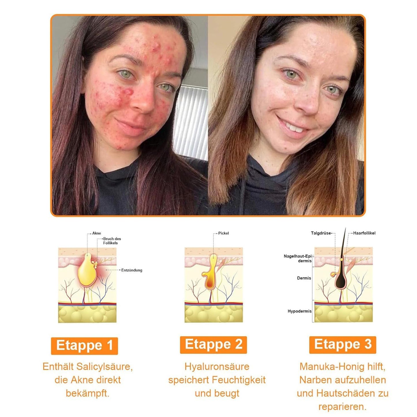 🔥 Buy 1 Get 1 FREE – Bee Venom Skin Repair Cream for Deep Hydration, Smoother Skin & Reduced Appearance of Fine Lines