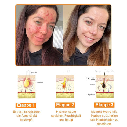 🔥 Buy 1 Get 1 FREE – Bee Venom Skin Repair Cream for Deep Hydration, Smoother Skin & Reduced Appearance of Fine Lines